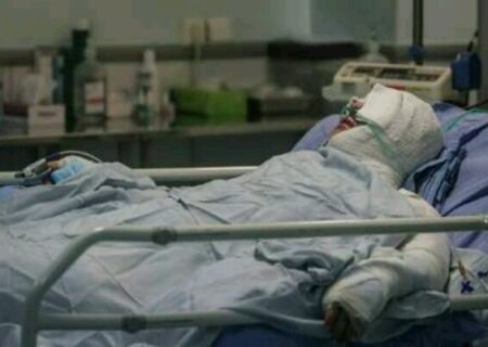 مرد ۳۷ ساله هنگام شست‌وشوی قطعات موتورسیکلت با بنزین در آتش سوخت