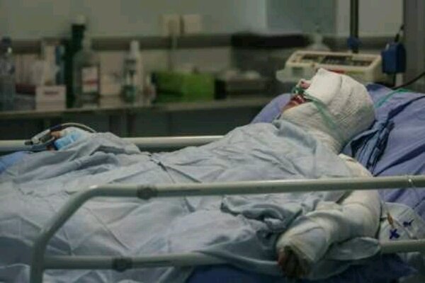 مرد ۳۷ ساله هنگام شست‌وشوی قطعات موتورسیکلت با بنزین در آتش سوخت
