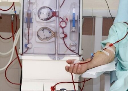 شناسایی زودهنگام خطر فیبریلاسیون دهلیزی با تغییرات چشم